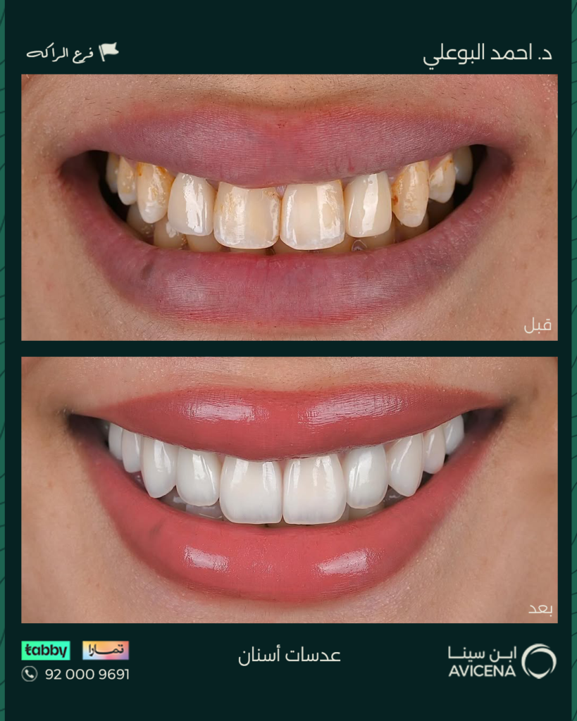 Dr. Ahmed Al-Bouali - Before After