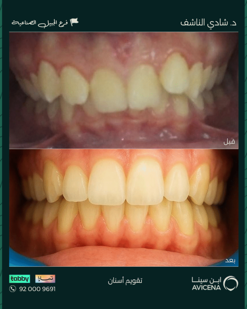 Dr. Shadi Al-Nashef - Before After