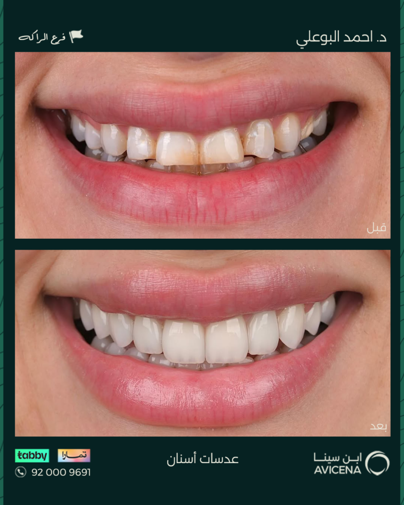 Dr. Ahmed Al-Bouali - Before After