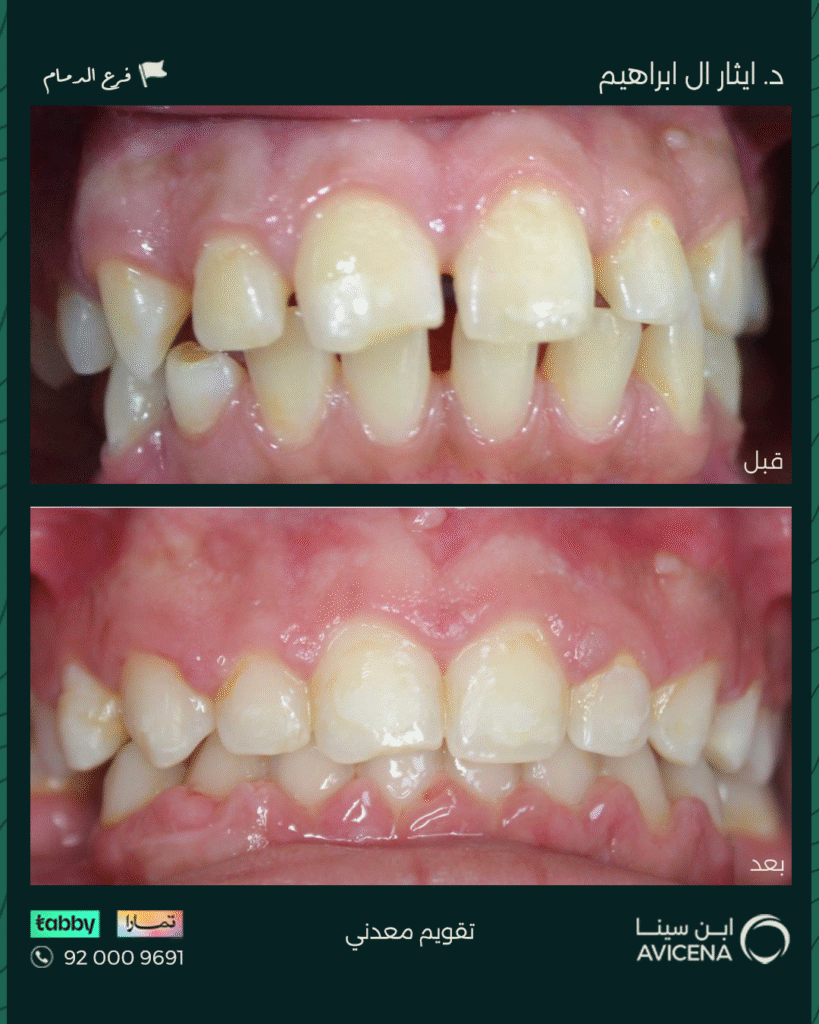 Dr. Ethar Basheer Al Ibrahim - Before After