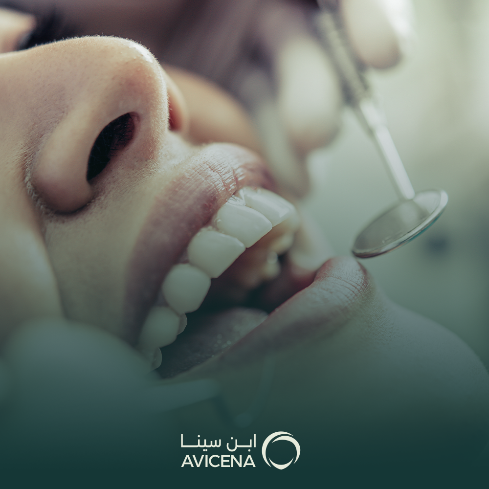 احسن انواع حشو الاسنان