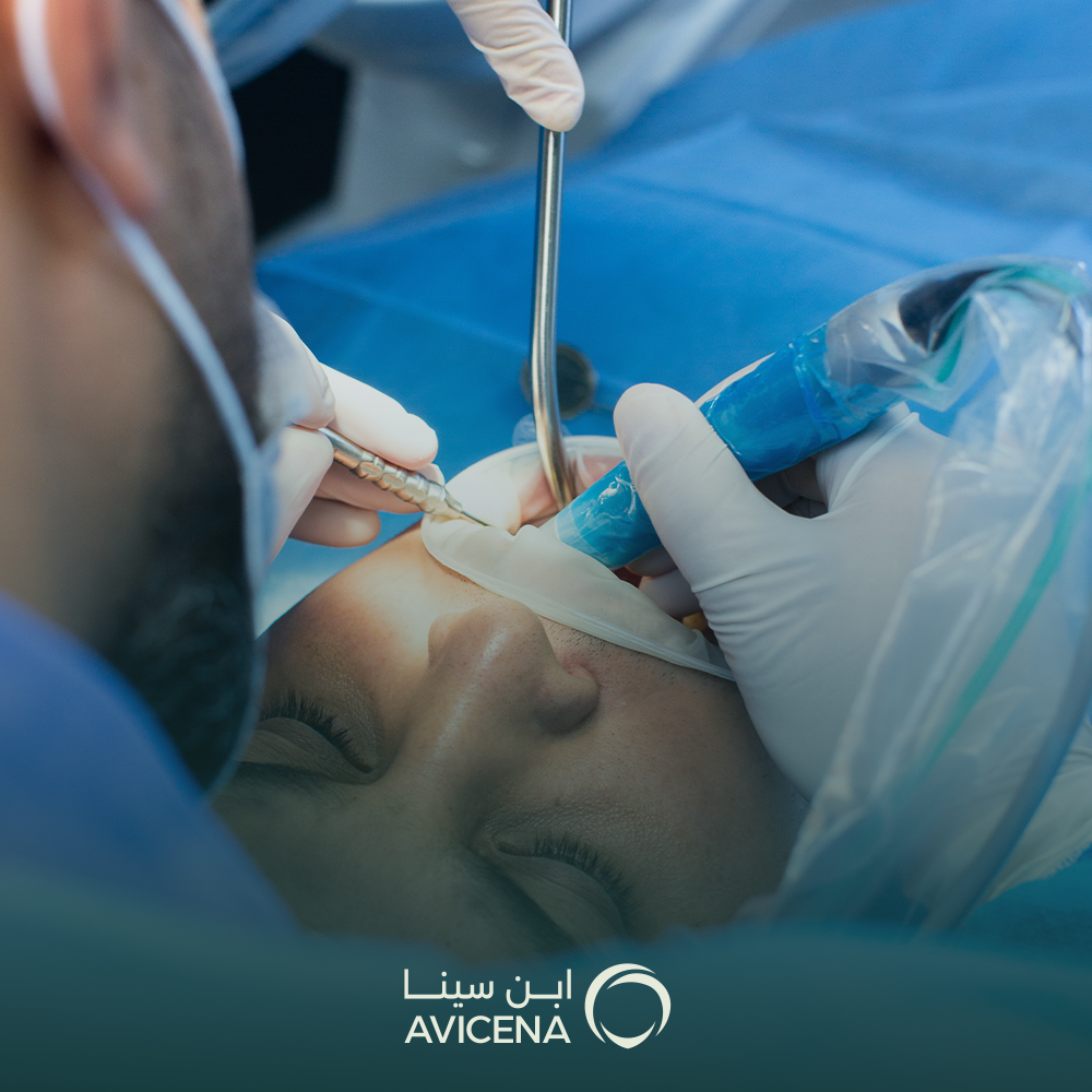 افضل انواع الاسنان التركيب