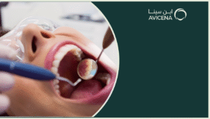 افضل انواع حشوة الاسنان واهم خطوات تطبيق الحشوة داخل عيادات ابن سينا