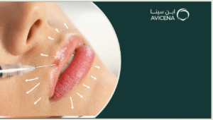افضل انواع فيلر الشفايف