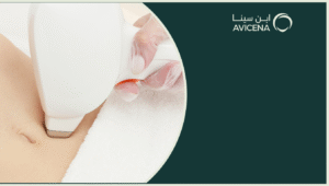 تعرف علي افضل جهاز ليزر للبكيني و كل ما تريد معرفته عن هذا الإجراء