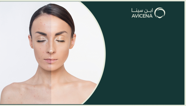احدث طرق علاج لتصبغات الوجه 2025