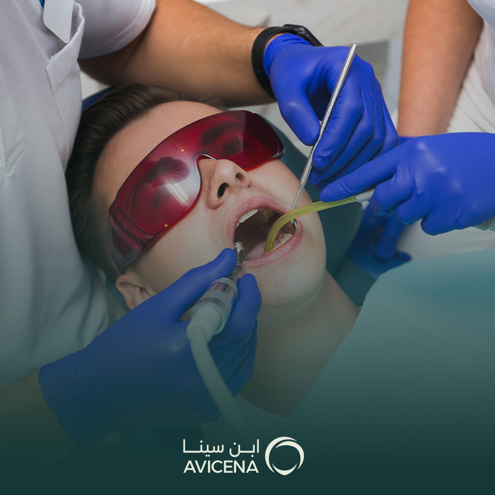 انواع حشوات الاسنان وافضلها