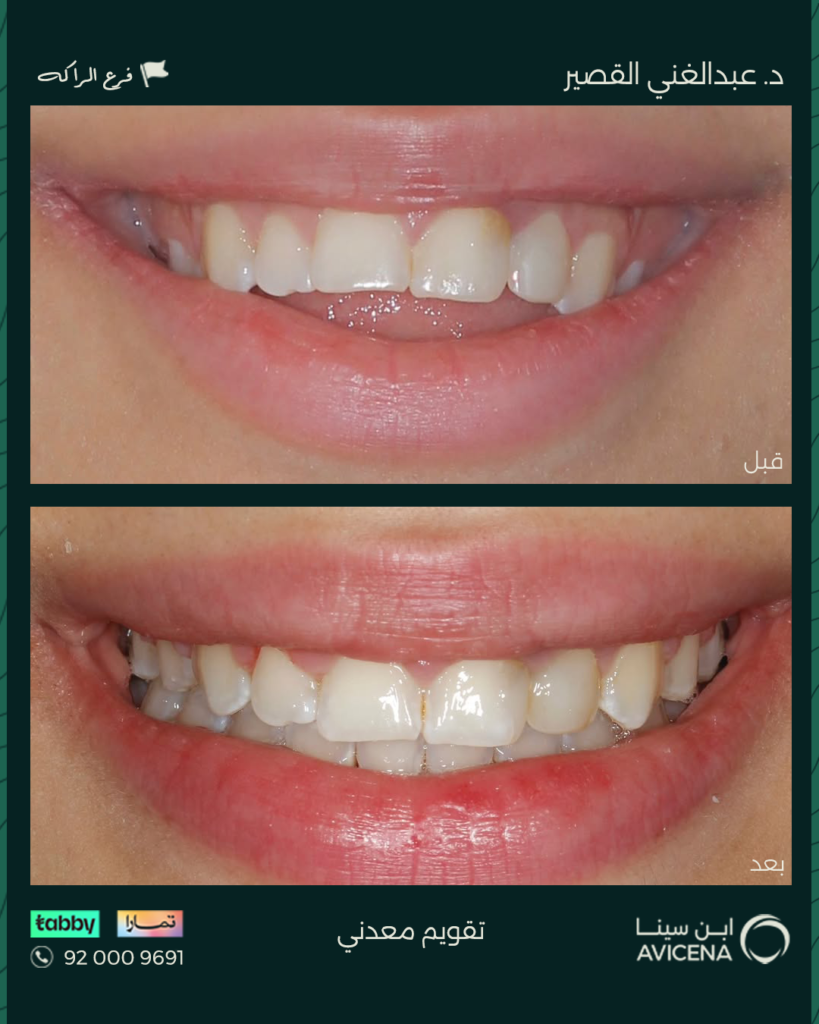 Dr. Abdelghani Ziyad Al-Qasir - Before After