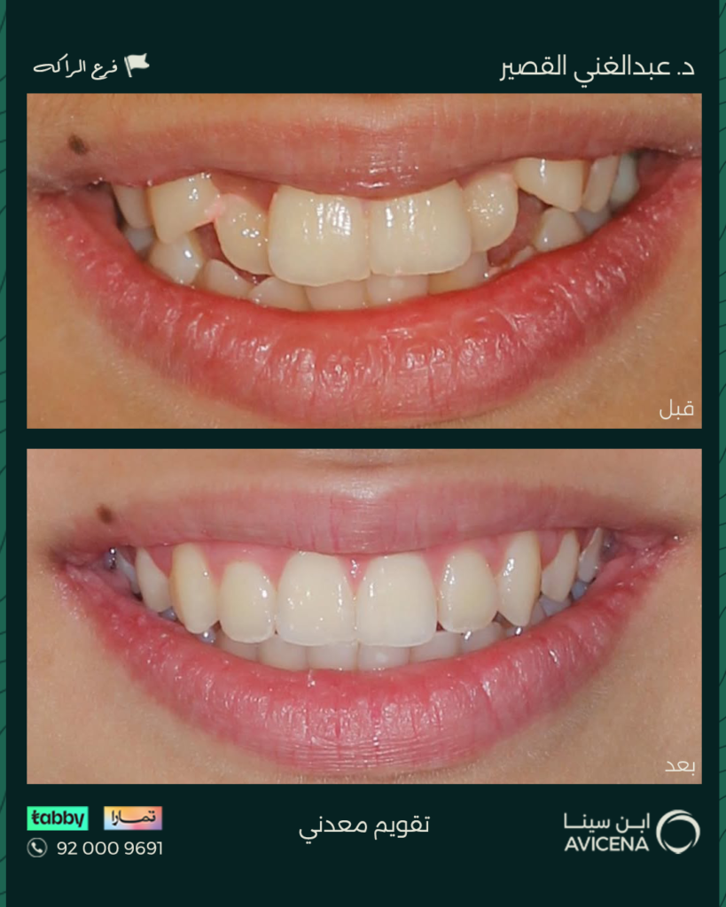 Dr. Abdelghani Ziyad Al-Qasir - Before After