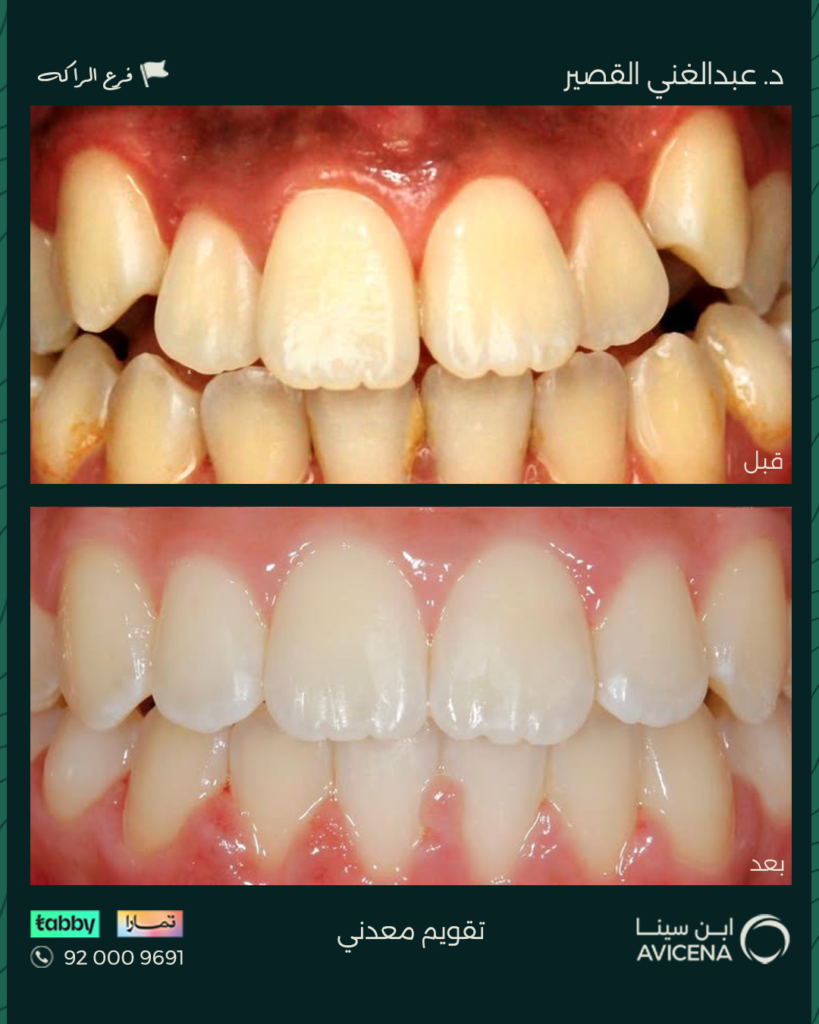 Dr. Abdelghani Ziyad Al-Qasir - Before After