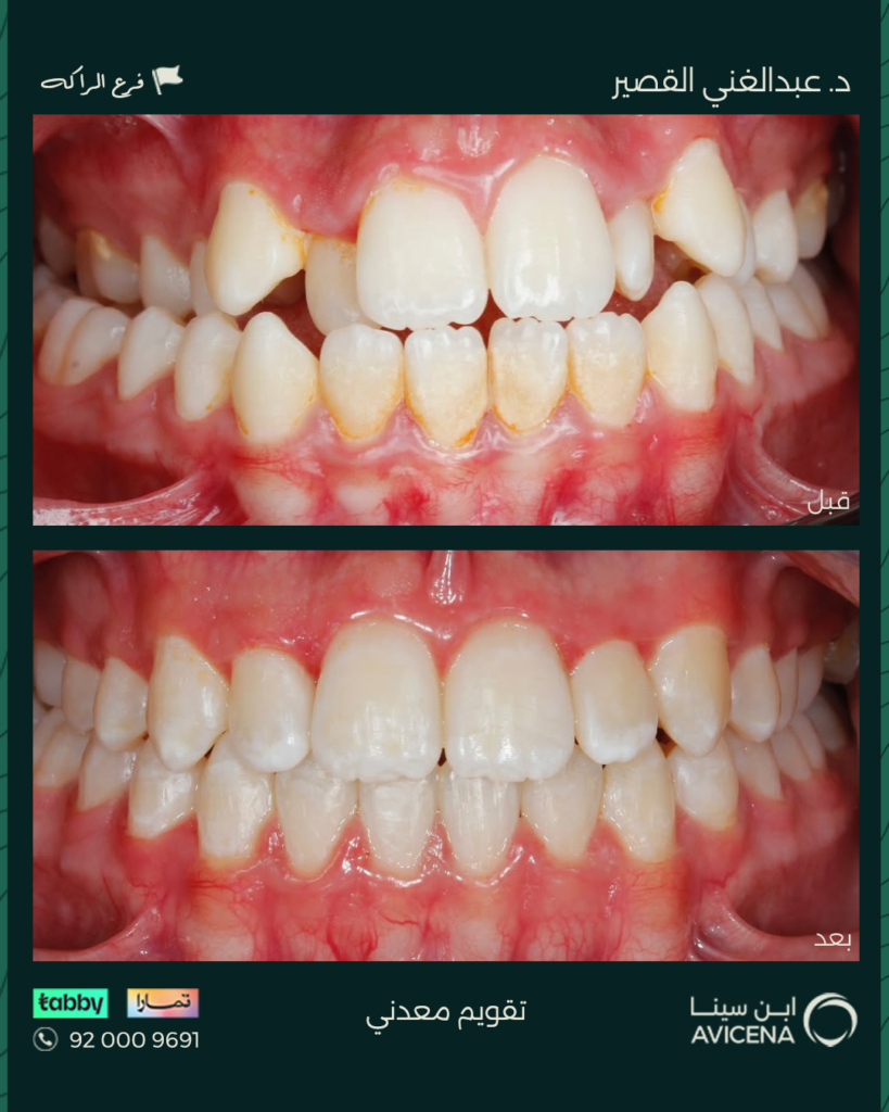 Dr. Abdelghani Ziyad Al-Qasir - Before After