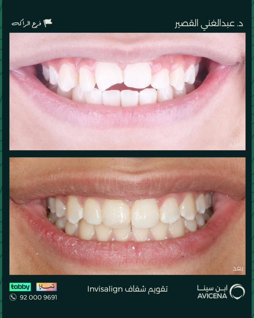 Dr. Abdelghani Ziyad Al-Qasir - Before After