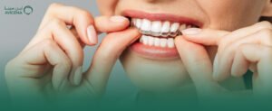 افضل دكتور تقوم اسنان شفاف انفزلاين في الخبر وكيفية الاستعداد قبل بدء تقويم Invisalign