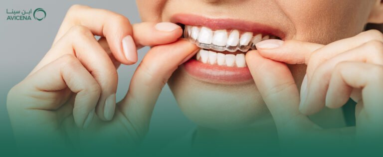 افضل دكتور تقوم اسنان شفاف انفزلاين في الخبر وكيفية الاستعداد قبل بدء تقويم Invisalign