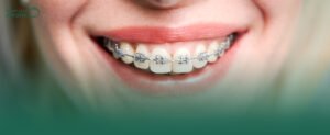 افضل دكتور تقويم اسنان في الدمام واهم التقنيات المستخدمة في ابن سينا