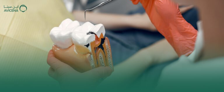افضل دكتور حشو وعلاج عصب اسنان في الخبر