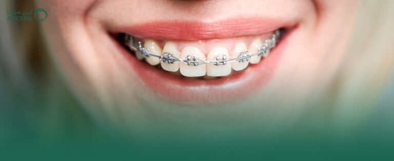 من هي افضل دكتورة تقويم أسنان بالدمام واهم أنواع التقويم التي تقدمها دكتورة تقويم أسنان بالدمام