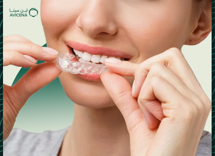 Invisalign
