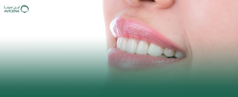 ابتسامة هوليود في المنطقة الشرقية كل ما تحتاج معرفته عن ابتسامة هوليود