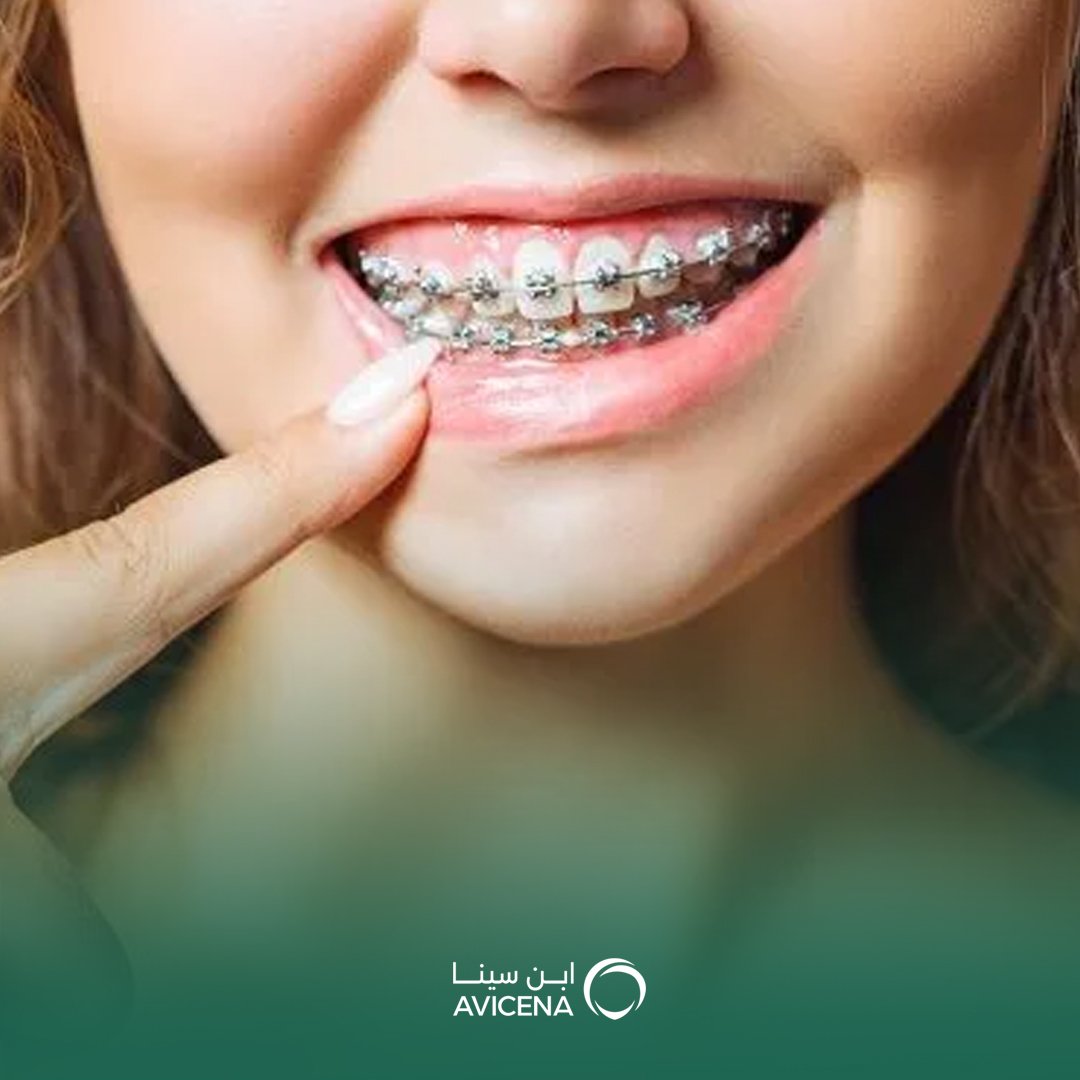 استشاري تقويم الأسنان الراكة