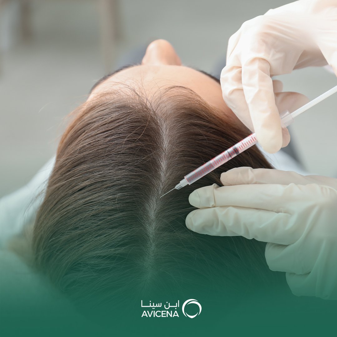 علاج تساقط الشعر بالبلازما في الجبيل