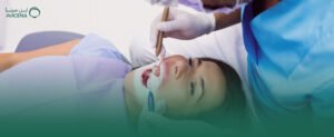 افضل دكتور عصب اسنان 2025
