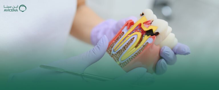 افضل طبيب اعادة علاج عصب اسنان في الخبر