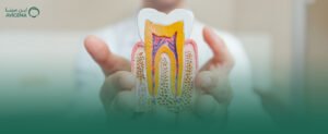 افضل طبيب علاج عصب اسنان في الخبر