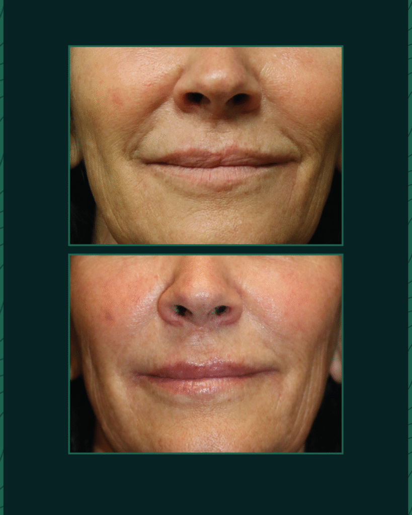 Potenza - Before After