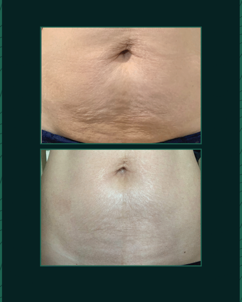 Potenza - Before After