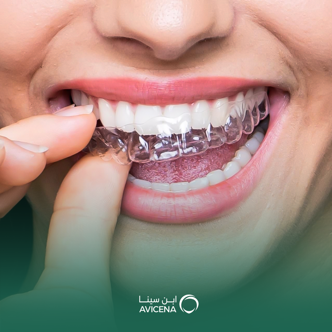 أفضل دكتور تقويم شفاف في الدمام