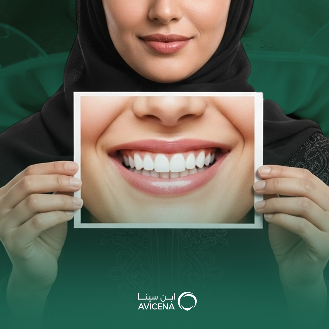 ابتسامة هوليود طبيعية في الدمام