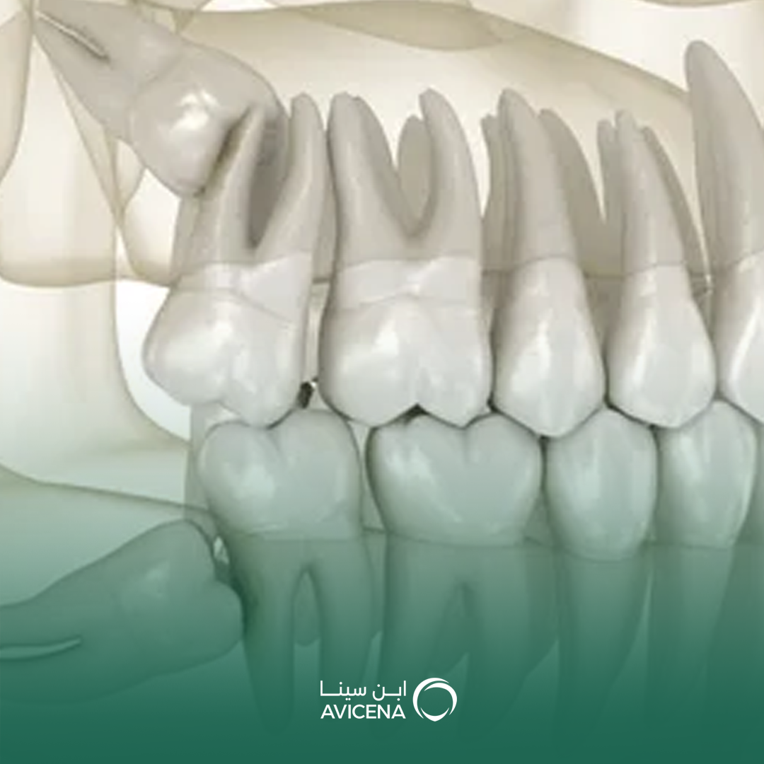 أفضل دكتور لعلاج بروز الأسنان في الخبر