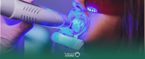أفضل تجربة لتنظيف الأسنان بالليزر في الدمام: دقة وأمان لابتسامة صحية