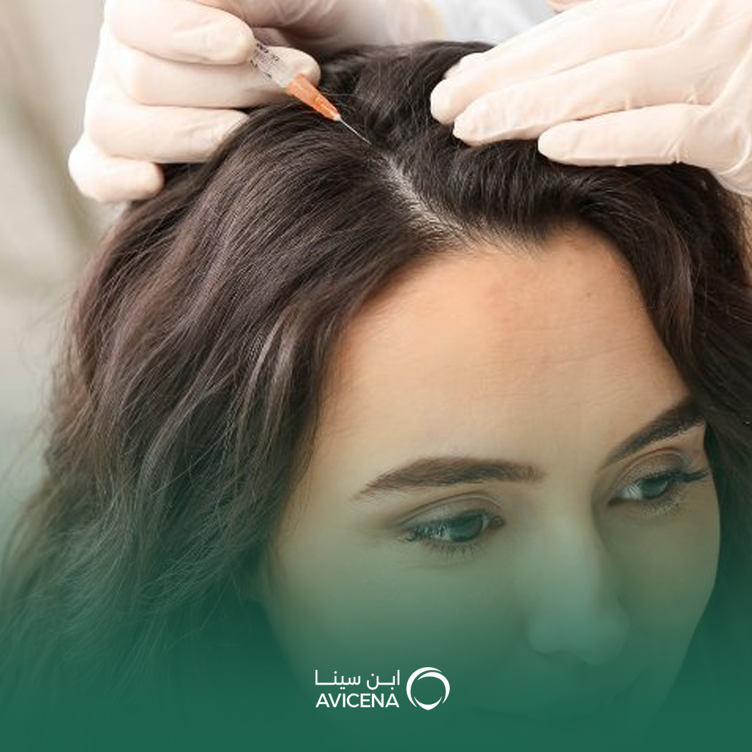 جلسات بلازما الشعر في الدمام