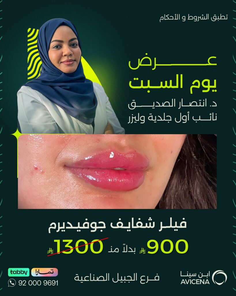 عرض فيلر شفايف