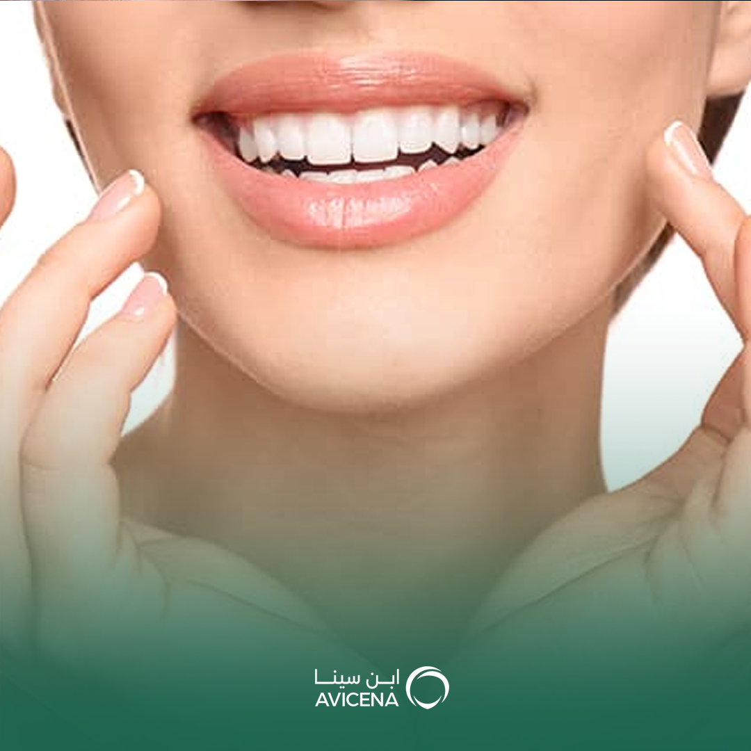 الابتسامة الهوليودية