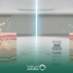 الفرق بين البروفايلو والسكلبترا: مقارنة شاملة للنتائج والاستخدامات