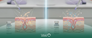 الفرق بين البروفايلو والسكلبترا: مقارنة شاملة للنتائج والاستخدامات