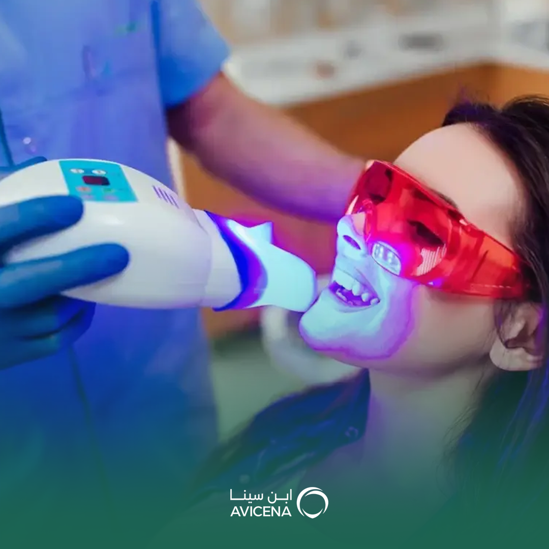 تبييض الأسنان بالليزر