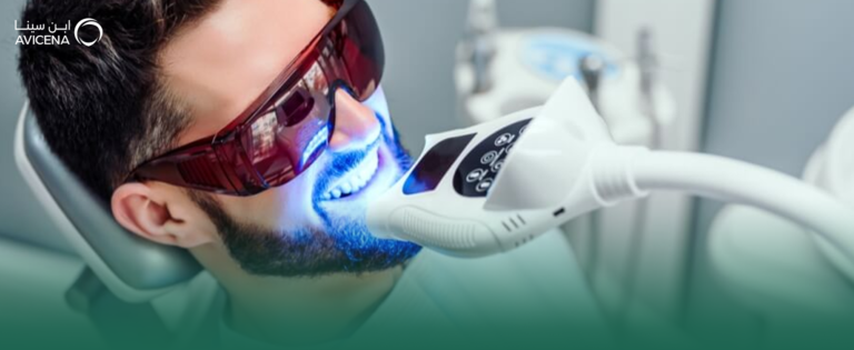 كل ما تود معرفته عن تبييض الأسنان بالليزر والفرق بينه وبين المنزلي
