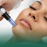 علاج آثار حب الشباب بجهاز Scarlet: الحل النهائي لبشرة صافية وناعمة