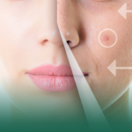 افضل دكتور فيلر الوجه في الدمام في 2026