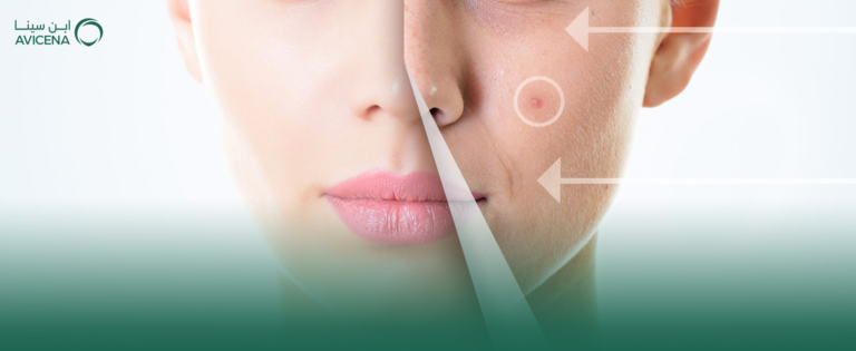 افضل دكتور فيلر الوجه في الدمام في 2026